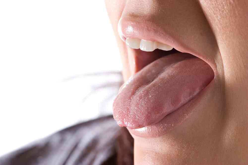 Featured image for “Put Out the Fire of Burning Mouth Syndrome”