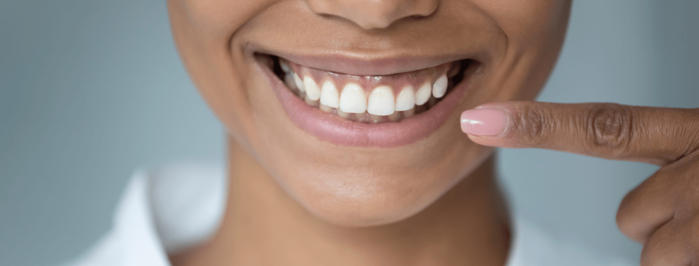 Featured image for “What to Expect From Cosmetic Dentistry”